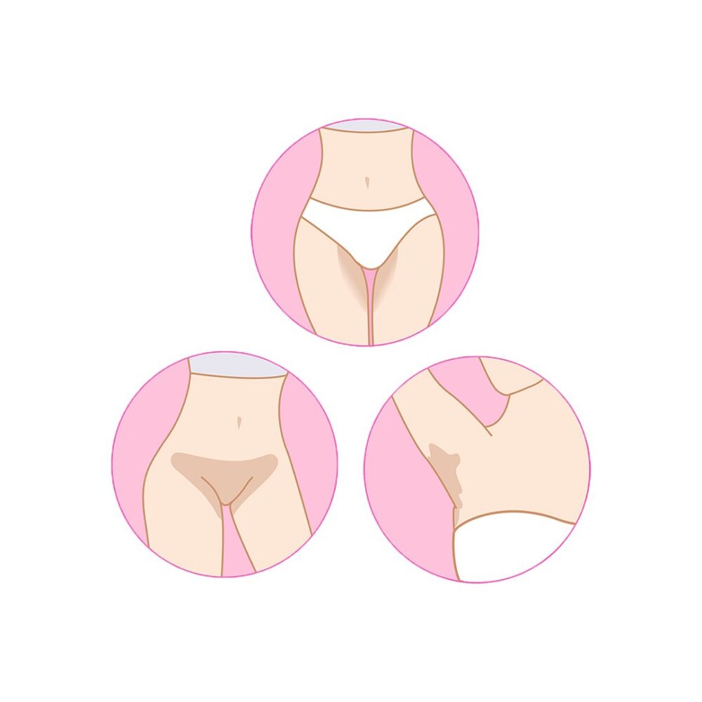 مرطب روز بيكيني لترطيب المناطق الحساسة